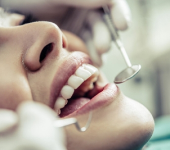 Salute: le cure dentali sono un lusso per pochi.